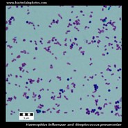 Haemophilus influenzae and pneumococcus under microscope